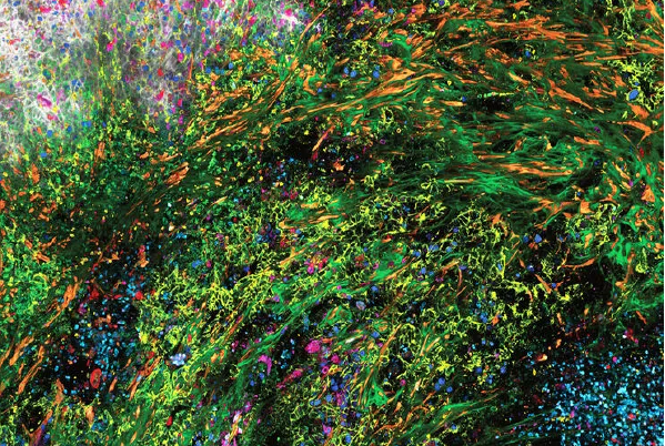 SpectraPlex 高涵量3D多重螢光成像系統 SpectraPlex 高涵量3D多重螢光成像系統